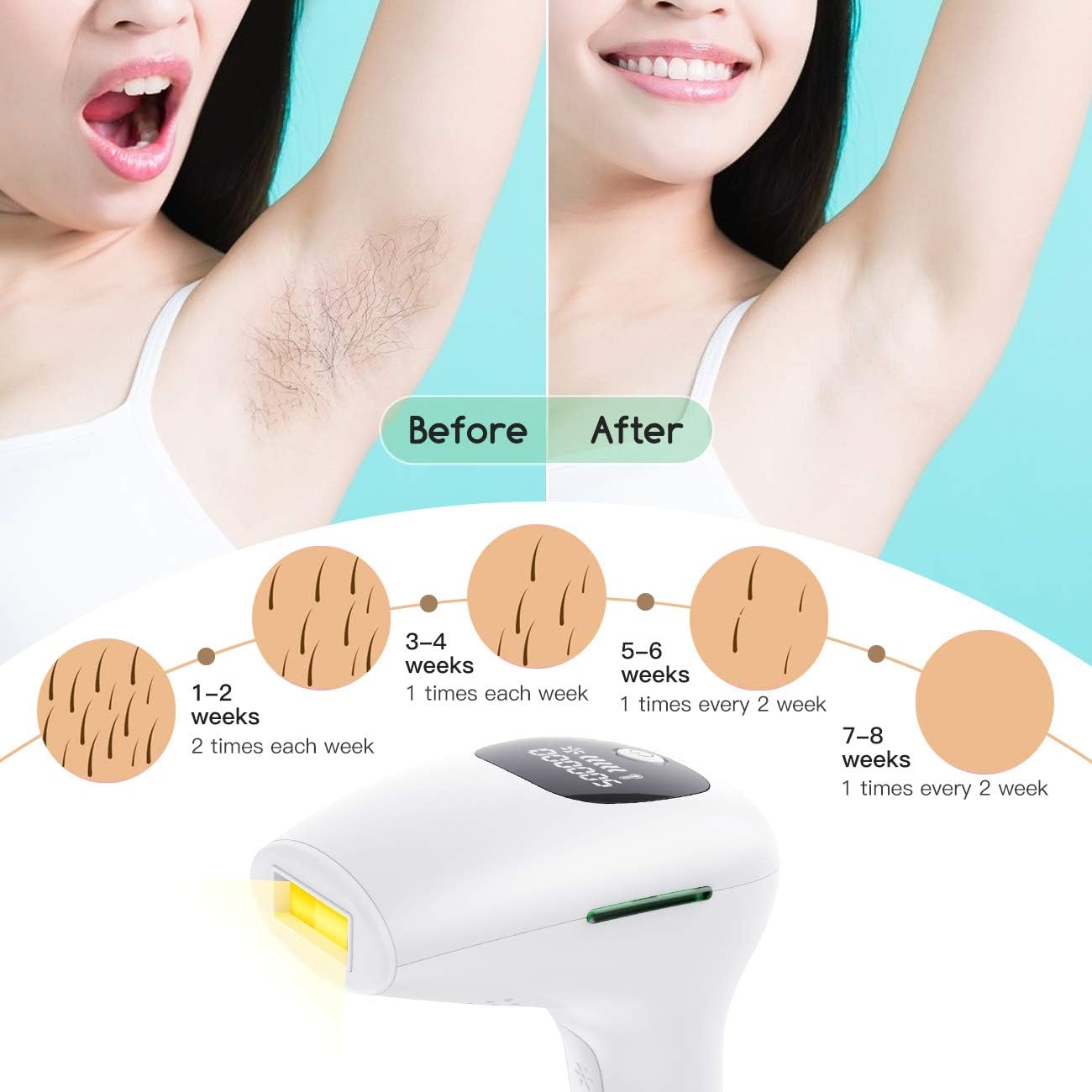 Professional IPL Laser Hair Removal Device